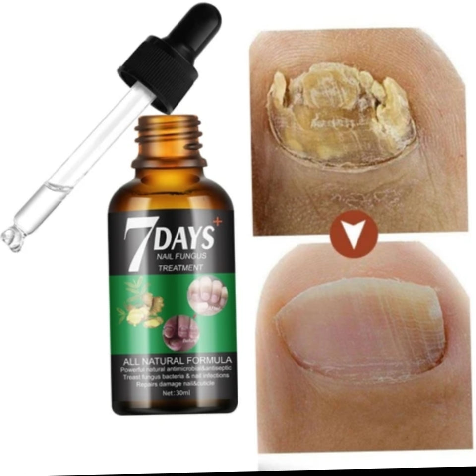 7DAYS  SERUM CONTRE LES MYCOSES DES ONGLES